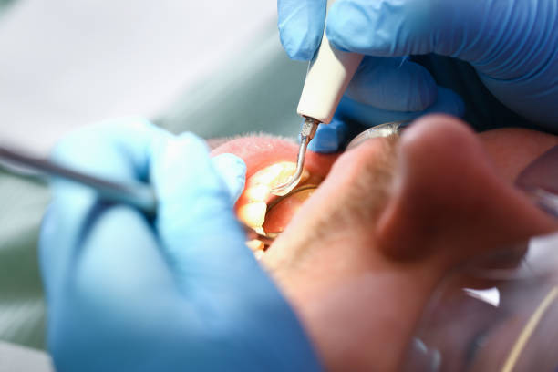 Best Broken or Cracked Tooth Emergency Dentist in Lofall, WA